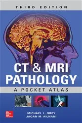 Book cover of CT & MRI Pathology: A Pocket Atlas, Third Edition (3rd ed.) by Michael L. Grey