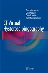 Book cover of CT Virtual Hysterosalpingography by Patricia Carrascosa