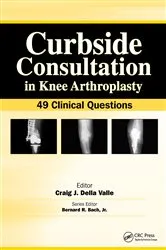 Book cover of Curbside Consultation in Knee Arthroplasty by Craig Della Valle