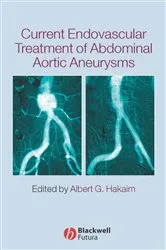 Book cover of Current Endovascular Treatment of Abdominal Aortic Aneurysms by Unknown
