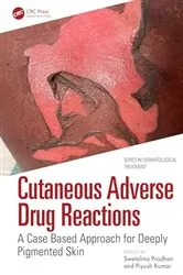 Book cover of Cutaneous Adverse Drug Reactions by Swetalina Pradhan