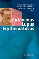 Book cover of Cutaneous Lupus Erythematosus by Annegret Kuhn