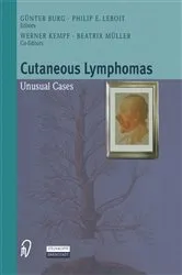 Book cover of Cutaneous Lymphomas by W. Kempf