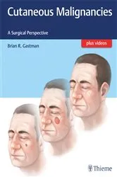 Book cover of Cutaneous Malignancies by Unknown