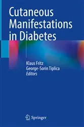 Book cover of Cutaneous Manifestations in Diabetes by Klaus Fritz