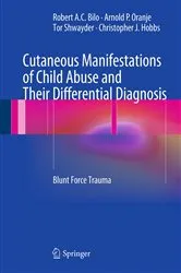 Book cover of Cutaneous Manifestations of Child Abuse and Their Differential Diagnosis by Robert A.C. Bilo
