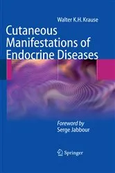 Book cover of Cutaneous Manifestations of Endocrine Diseases by Walter K.H. Krause