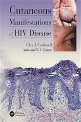 Book cover of Cutaneous Manifestations of HIV Disease by Clay Cockerell