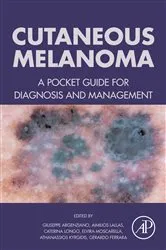 Book cover of Cutaneous Melanoma by Unknown