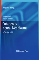 Book cover of Cutaneous Neural Neoplasms by Zsolt Argenyi