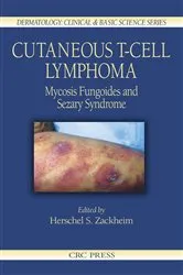 Book cover of Cutaneous T-Cell Lymphoma by Herschel S. Zackheim