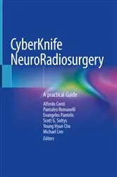 Book cover of CyberKnife NeuroRadiosurgery by Alfredo Conti