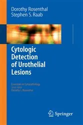 Book cover of Cytologic Detection of Urothelial Lesions by Dorothy L. Rosenthal