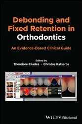 Book cover of Debonding and Fixed Retention in Orthodontics by Theodore Eliades
