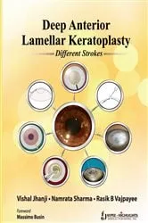 Book cover of Deep Anterior Lamellar Keratoplasty by Jhanji Vishal