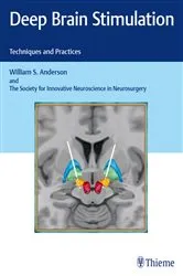 Book cover of Deep Brain Stimulation by Kelvin L. Chou