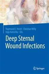 Book cover of Deep Sternal Wound Infections by Raymund E. Horch