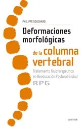Book cover of Deformaciones morfológicas de la columna vertebral by Philippe Souchard