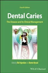 Book cover of Dental Caries (4th ed.) by Ole Fejerskov