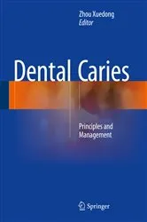 Book cover of Dental Caries by Unknown