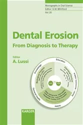 Book cover of Dental Erosion by A. Lussi