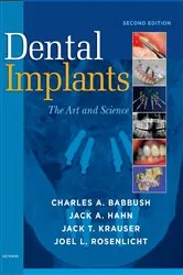 Book cover of Dental Implants (2nd ed.) by Unknown