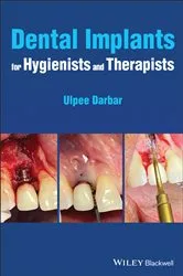 Book cover of Dental Implants for Hygienists and Therapists by Ulpee R. Darbar