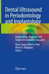 Book cover of Dental Ultrasound in Periodontology and Implantology by Hsun-Liang (Albert) Chan