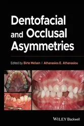Book cover of Dentofacial and Occlusal Asymmetries by Birte Melsen