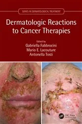 Book cover of Dermatologic Reactions to Cancer Therapies by Gabriella Fabbrocini