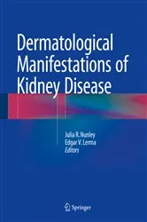 Book cover of Dermatological Manifestations of Kidney Disease by Julia R. Nunley