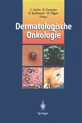 Book cover of Dermatologische Onkologie by Claus Garbe