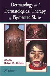 Book cover of Dermatology and Dermatological Therapy of Pigmented Skins by Rebat Halder