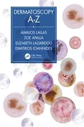 Book cover of Dermatoscopy A-Z by Aimilios Lallas
