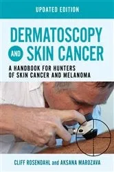 Book cover of Dermatoscopy and Skin Cancer, updated edition by Cliff Rosendahl