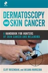Book cover of Dermatoscopy and Skin Cancer by Unknown
