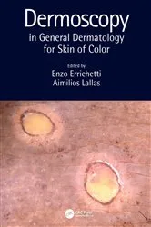 Book cover of Dermoscopy in General Dermatology for Skin of Color by Unknown