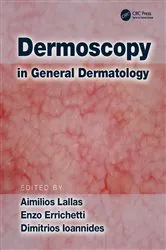 Book cover of Dermoscopy in General Dermatology by Aimilios Lallas