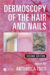 Book cover of Dermoscopy of the Hair and Nails (2nd ed.) by Antonella Tosti