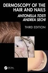 Book cover of Dermoscopy of the Hair and Nails 3e (3rd ed.) by Antonella Tosti
