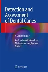 Book cover of Detection and Assessment of Dental Caries by Andrea Ferreira Zandona