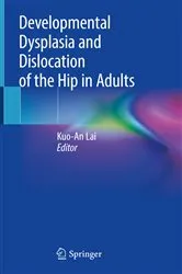 Book cover of Developmental Dysplasia and Dislocation of the Hip in Adults by Kuo-An Lai