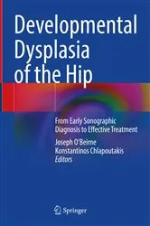 Book cover of Developmental Dysplasia of the Hip by Joseph O'Beirne
