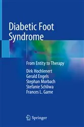 Book cover of Diabetic Foot Syndrome by Dirk Hochlenert