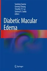Book cover of Diabetic Macular Edema by Sandeep Saxena