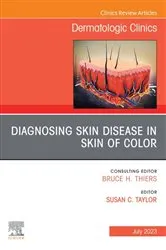 Book cover of Diagnosing Skin Disease in Skin of Color, An Issue of Dermatologic Clinics, E-Book by Susan C. Taylor MD