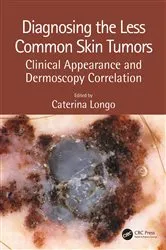 Book cover of Diagnosing the Less Common Skin Tumors by Caterina Longo