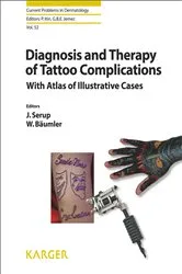 Book cover of Diagnosis and Therapy of Tattoo Complications by J. Serup