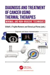Book cover of Diagnosis and Treatment of Cancer using Thermal Therapies by Citlalli J. Trujillo Romero