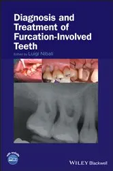 Book cover of Diagnosis and Treatment of Furcation-Involved Teeth by Luigi Nibali